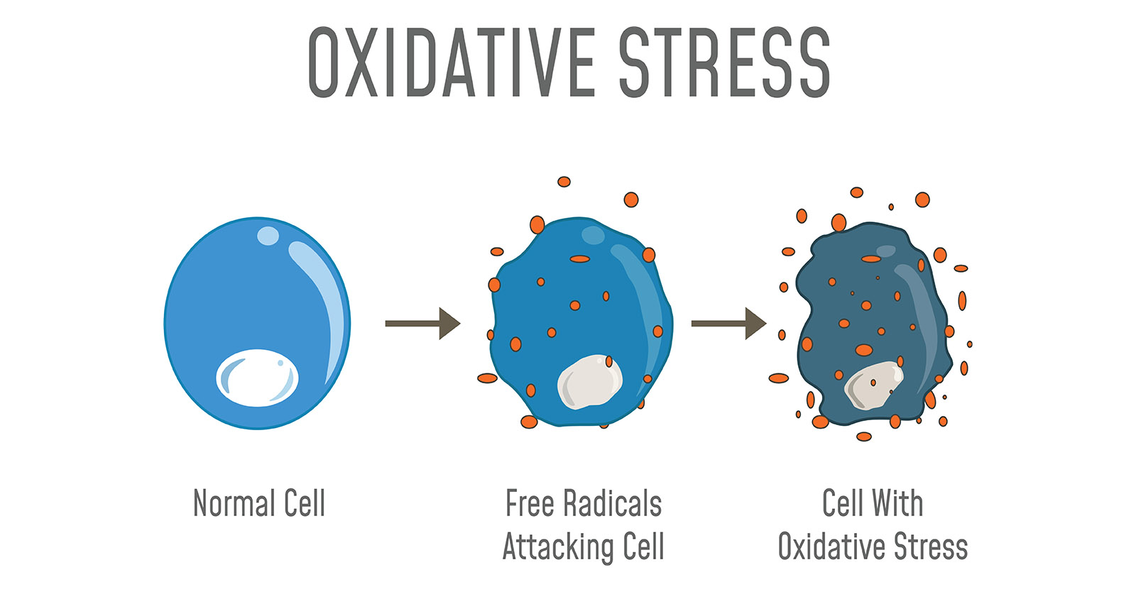 study-shows-oxidative-stress-and-impaired-methylation-are-hallmarks-of